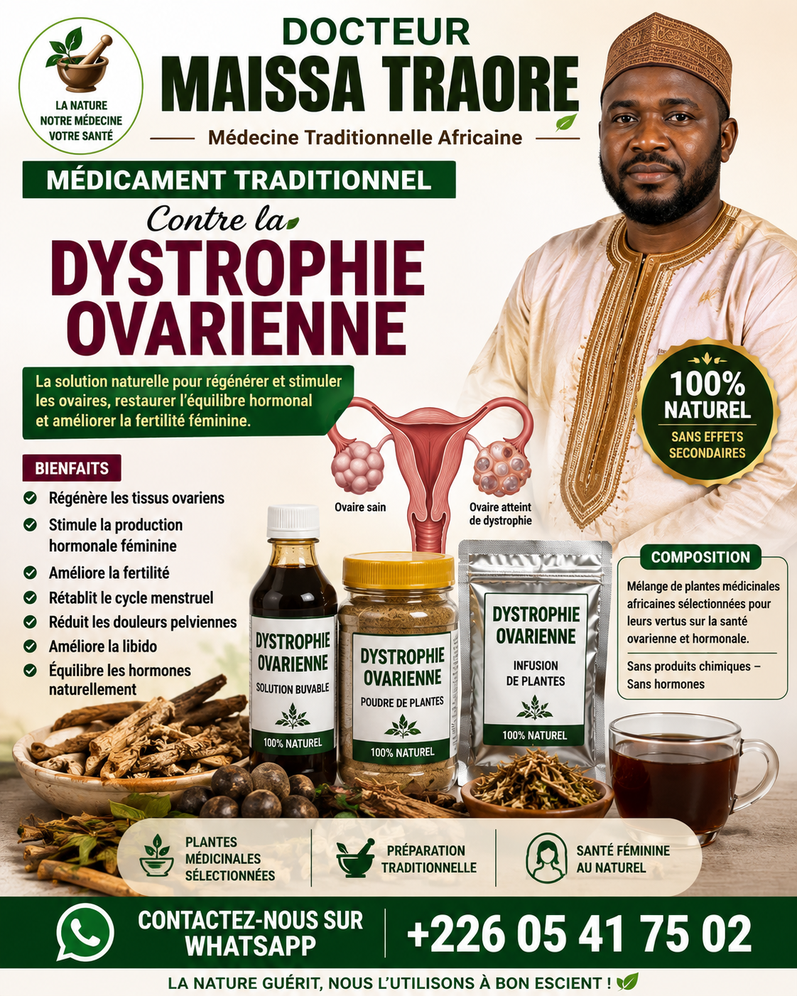La dystrophie ovarienne, très souvent liée au Syndrome des Ovaires Polykystiques (SOPK), est un désordre hormonal et métabolique fréquent chez la femme en âge de procréer. Elle se caractérise par une accumulation de petits follicules immatures dans les ovaires, un arrêt ou une irrégularité des ovulations (anovulation), ainsi qu'un excès d'hormones androgènes. Cela se traduit au quotidien par des cycles irréguliers, de l'acné, de l'hirsutisme, une prise de poids ou des difficultés à concevoir.